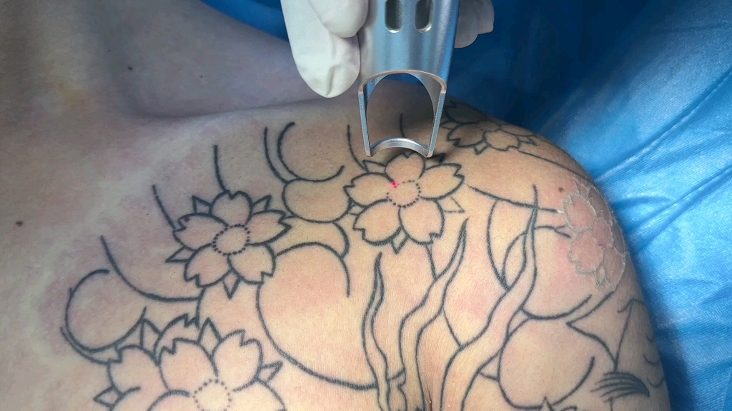 线条纹身沉浸式清洗过程记录