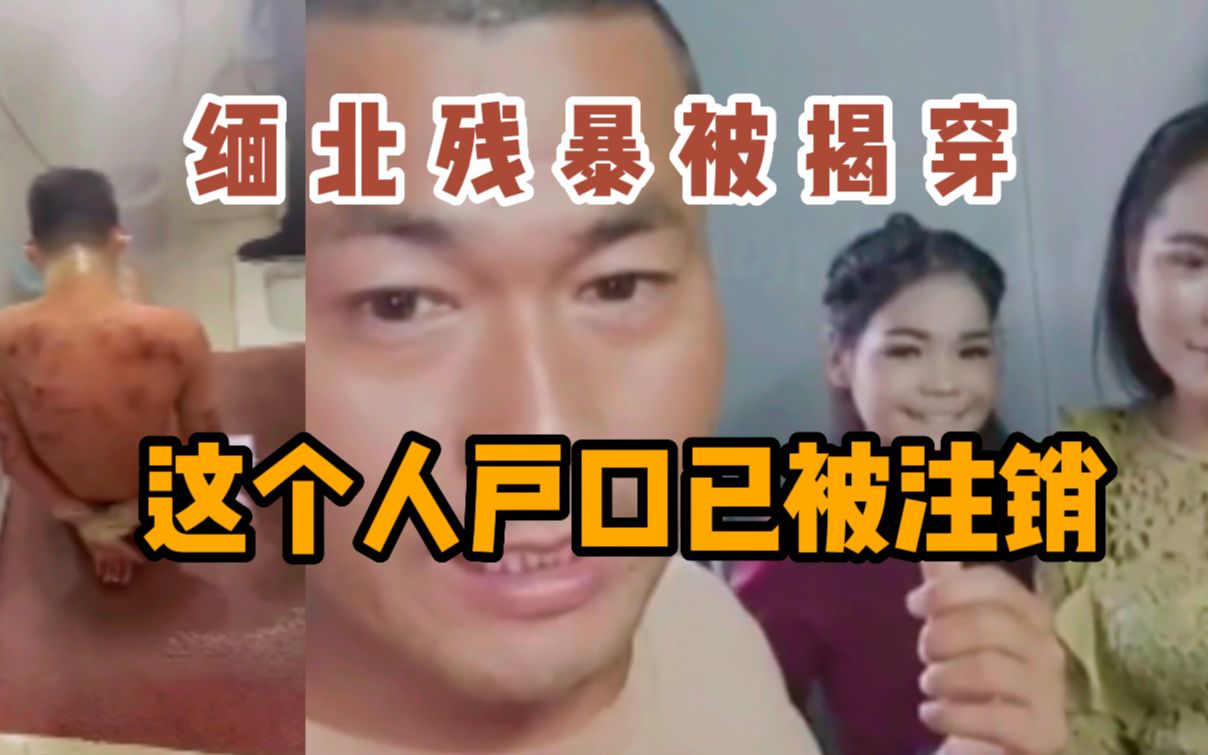 [图]在缅北被注销户口的安徽人爆料，他在诈骗集团看到的那些血腥场面