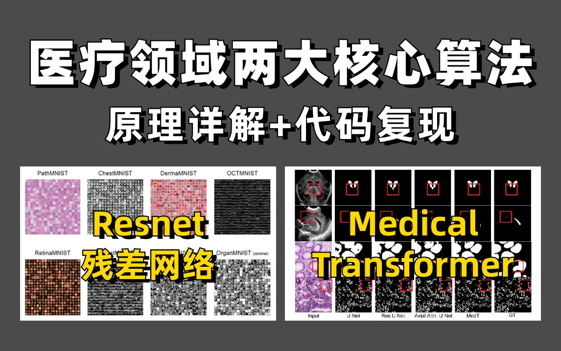 未来蓝海?AI+医疗方向核心两大算法:残差网络Resnet+医疗Transformer被同济大佬用大白话讲明白了!哔哩哔哩bilibili