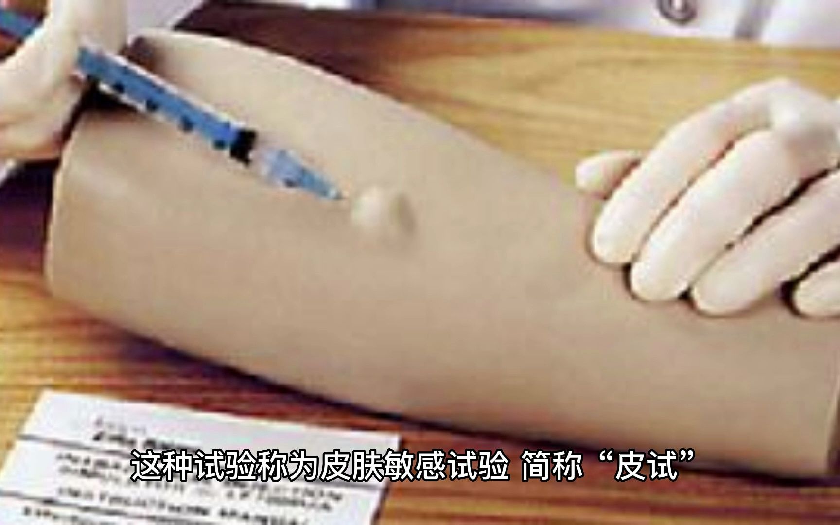 注射青霉素为什么需要皮试?哔哩哔哩bilibili