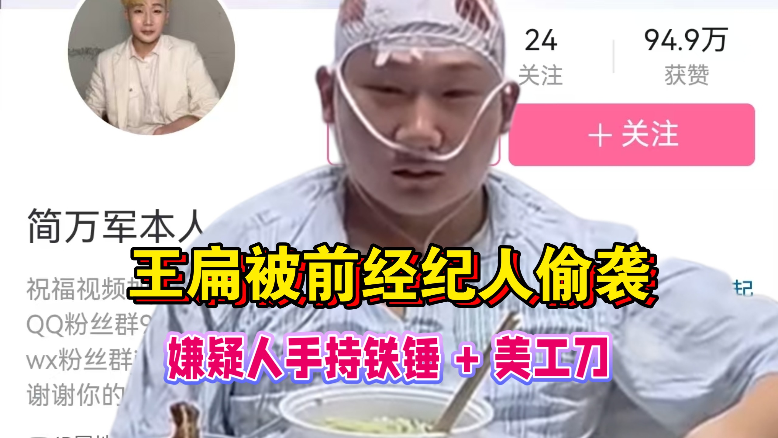 太炸了！10月19日 靠模仿王源出圈的王扁，昨晚在烧烤摊前遭前经纪人袭击：嫌疑人手持铁锤！