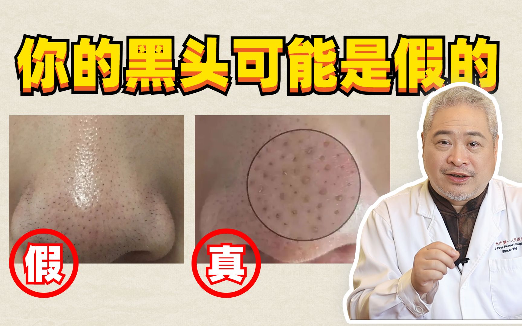 维a酸凝胶的功效(维a酸凝胶,祛痘祛斑好帮手)