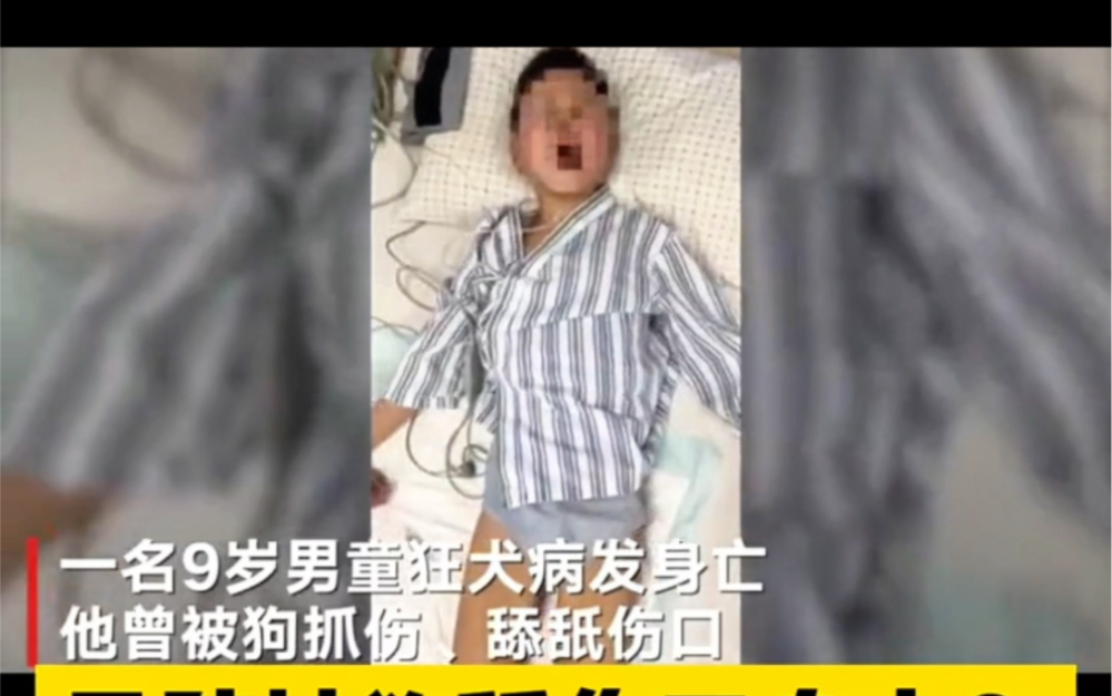 [图]#小孩被狗抓伤后现狂犬病症状 #小孩被狗抓伤后发病死亡仅20天