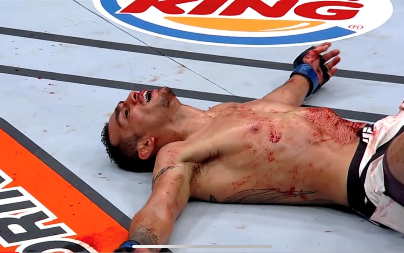 ufc托尼弗格森vs腿王巴博萨肘过如刀血流如注巅峰夜魔多强