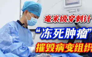 Download Video: 冻死癌细胞，被证实有效！零下160℃超低温，十几分钟摧毁肿瘤