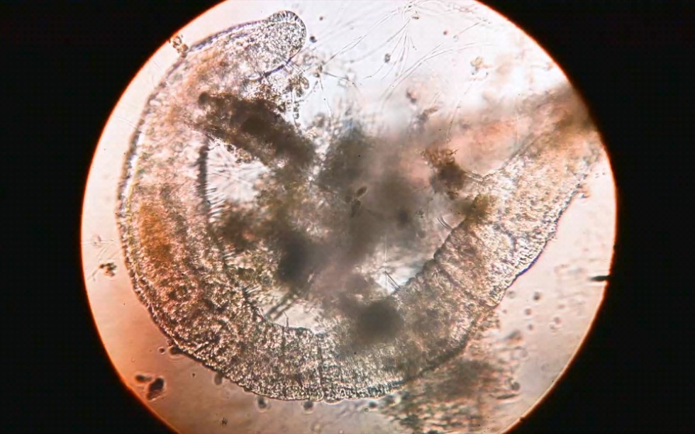 显微镜下观察琴湖的水