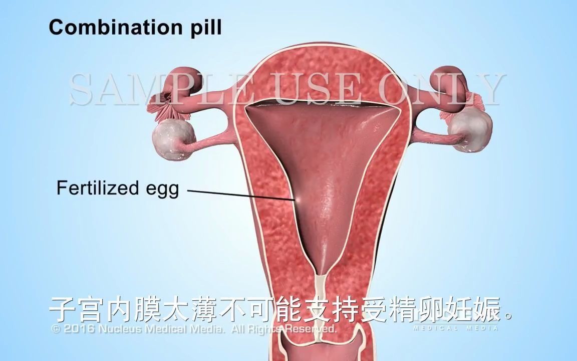 多多女性医学科普【3d医学动画】避孕药的功能和原理
