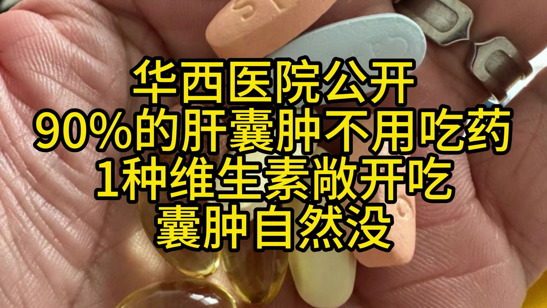 華西醫院公開:90%的肝囊腫不用吃藥,1種維生素敞開吃,囊腫自然沒