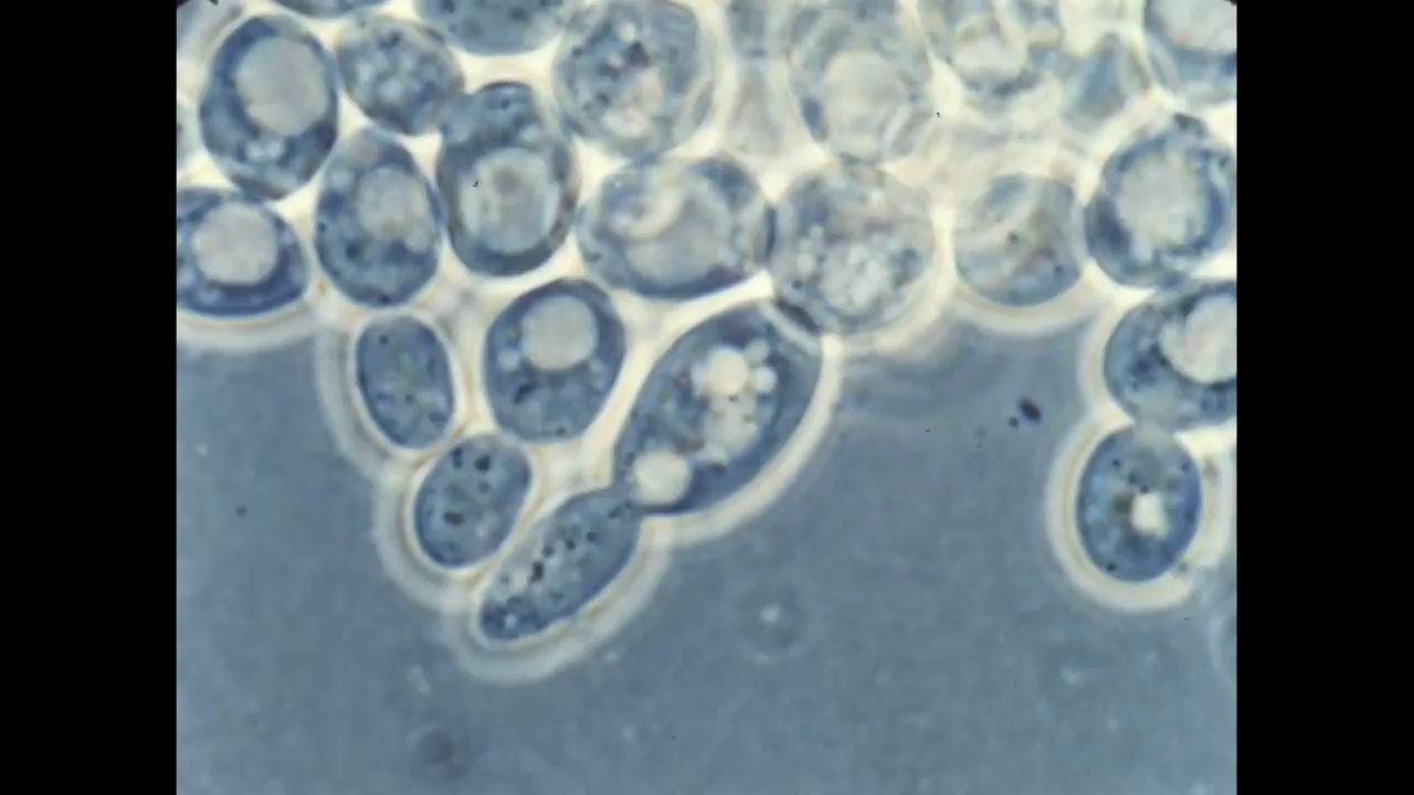 [图]酵母細胞的出芽生殖 Yeast Cells - UMAL57