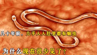 你的肚子里有多少蛔虫 寄生虫病有多可怕 猫脱maotalk 哔哩哔哩 Bilibili