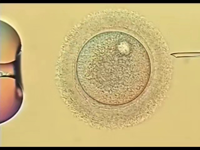 人工受精 显微镜下的操作哔哩哔哩bilibili
