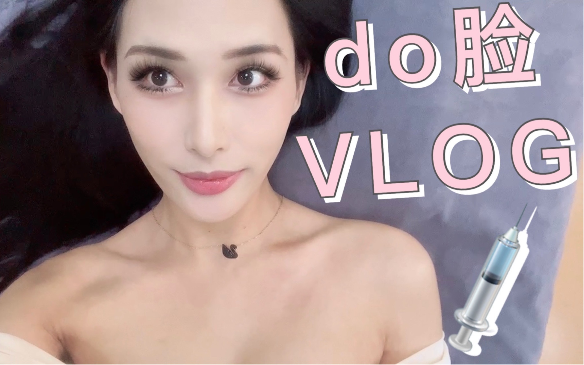科技美女do脸填充vlog|5支 欣菲聆 bns 啵啵 |太阳穴 脸颊 凹陷 填充