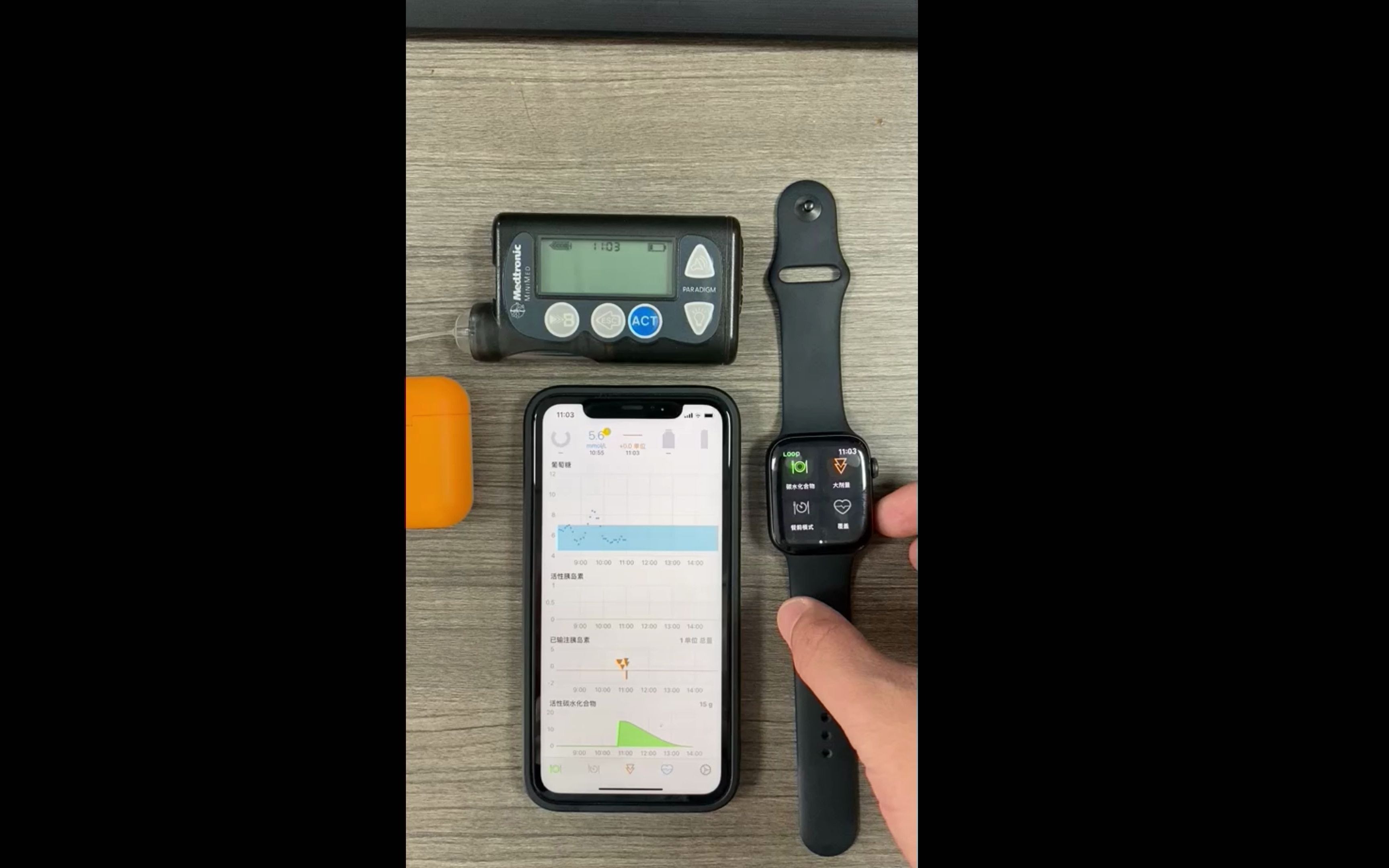 美敦力胰岛素泵智能输注,苹果手表遥控输注哔哩哔哩bilibili