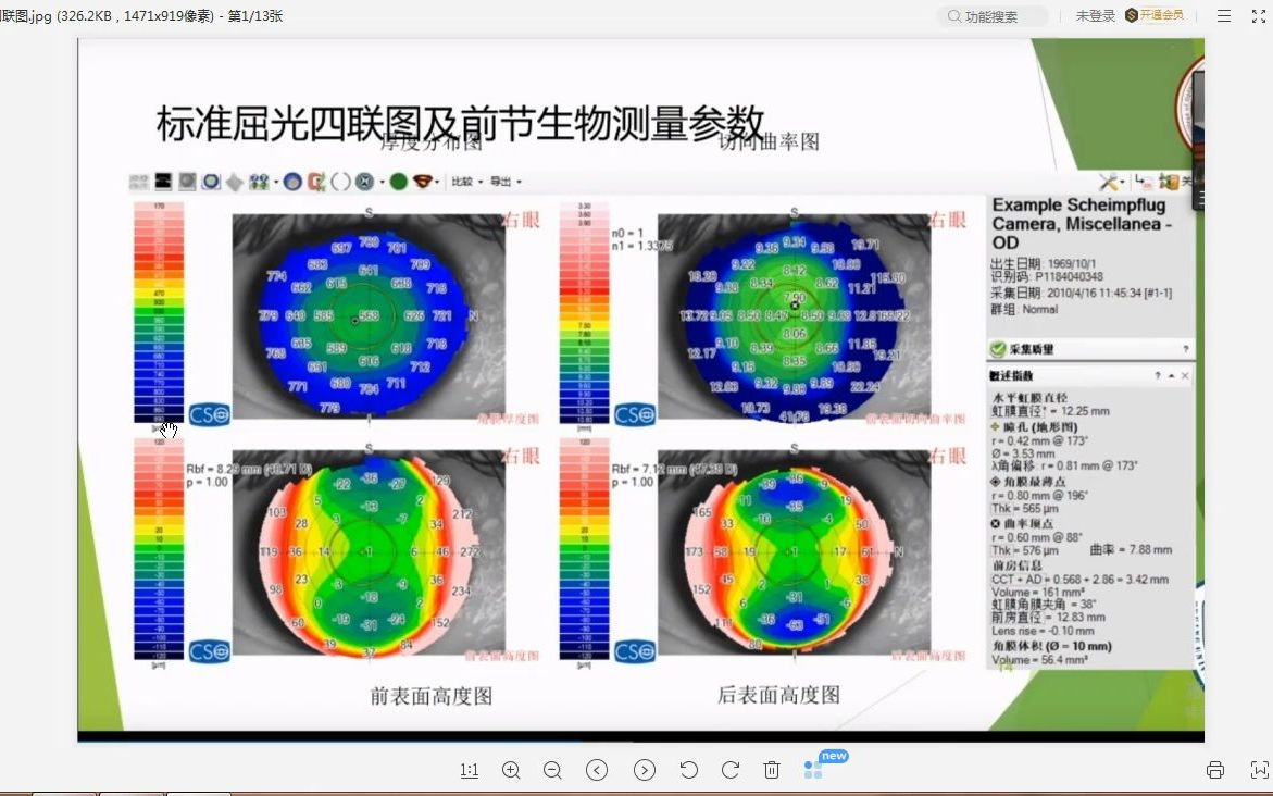 五分钟 快速入门角膜地形图哔哩哔哩bilibili