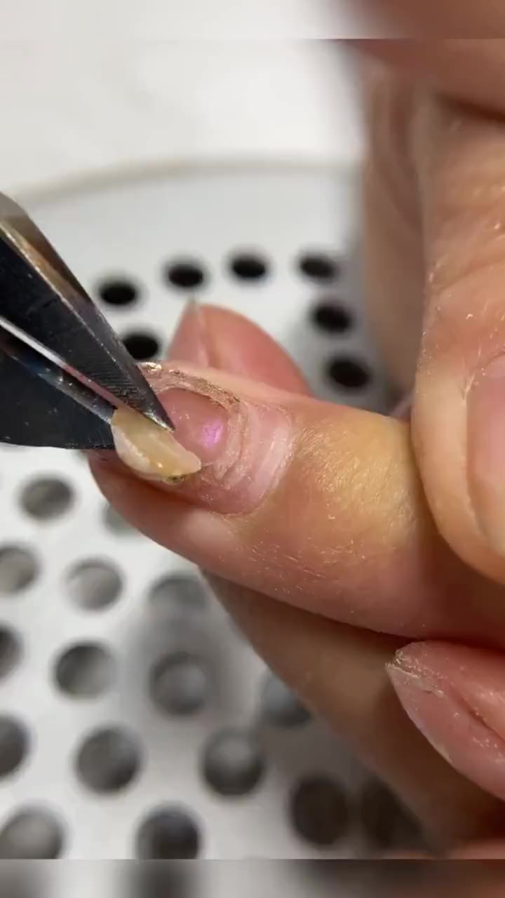 第一眼以为指甲烂了,要剪掉.