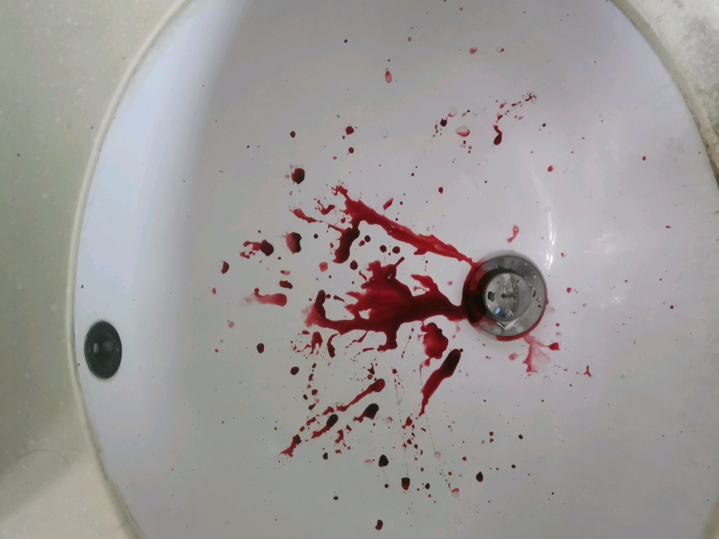 当我用假血包整蛊我妹时