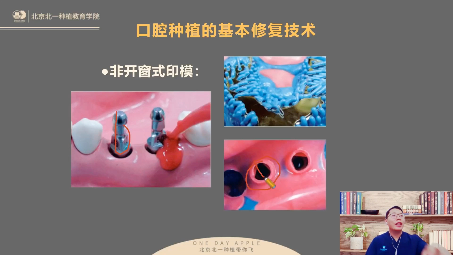 北医王明种植初级班 —种植修复取模(实战课)