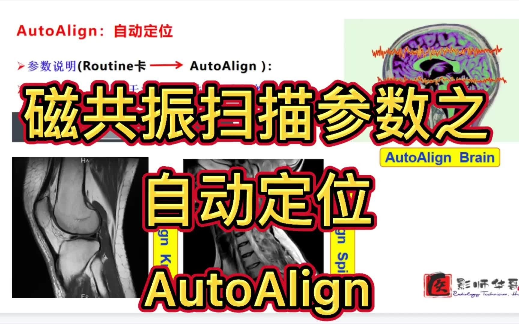 「磁共振序列解说」西门子参数卡解说之自动定位AutoAlign哔哩哔哩bilibili