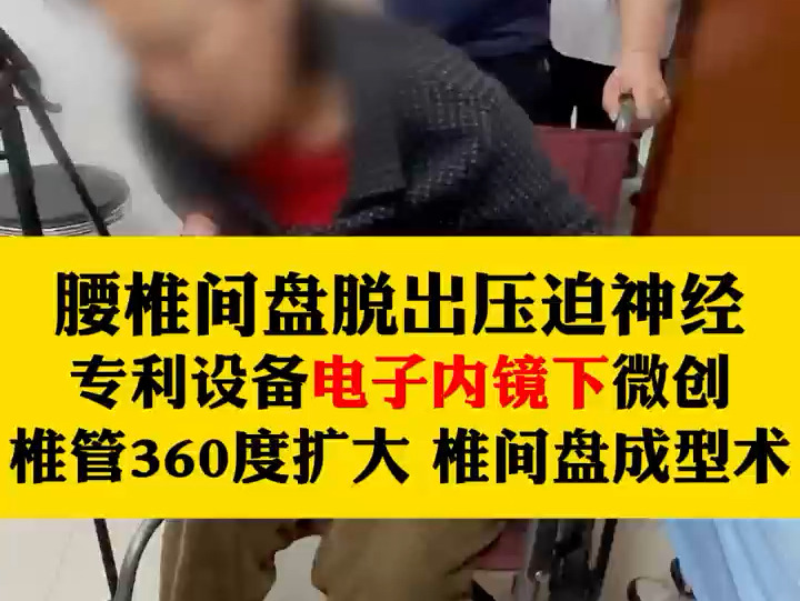 腰椎间盘脱出压迫神经专利设备电子内镜下微创椎管360度扩大、椎间盘修复成型术哔哩哔哩bilibili