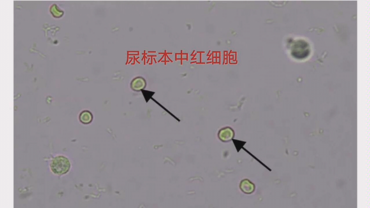 医学检验技术哔哩哔哩bilibili