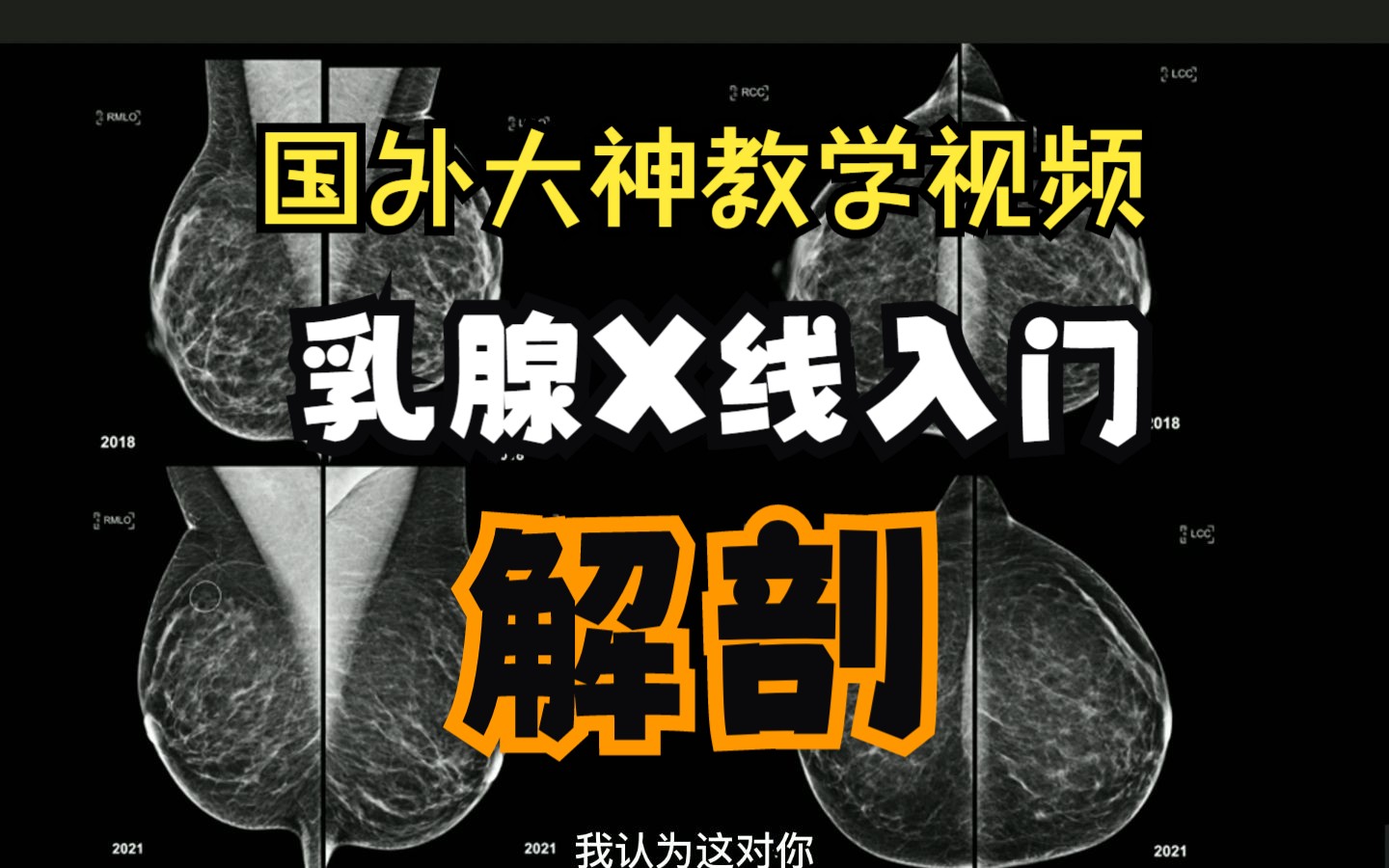 乳腺X线入门解读—解剖和位置(国外大神教学视频)哔哩哔哩bilibili