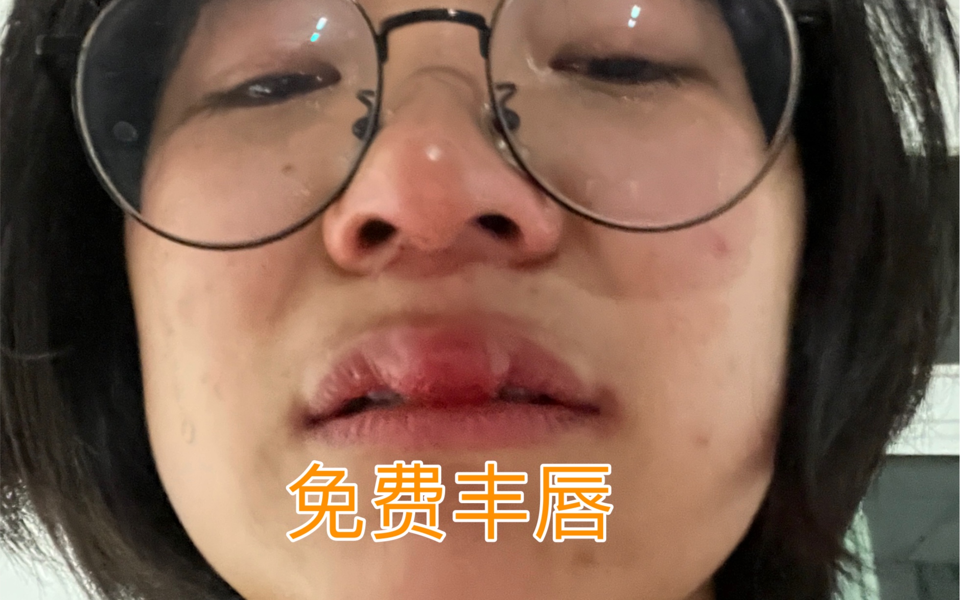 [图]告诉朋友骑车把牙磕掉了把嘴摔肿了，她看见我笑得直不起腰，看看我交的好朋友吧:)