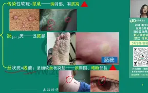 Download Video: 2023年中医外科学高频串讲（3）-潇婷