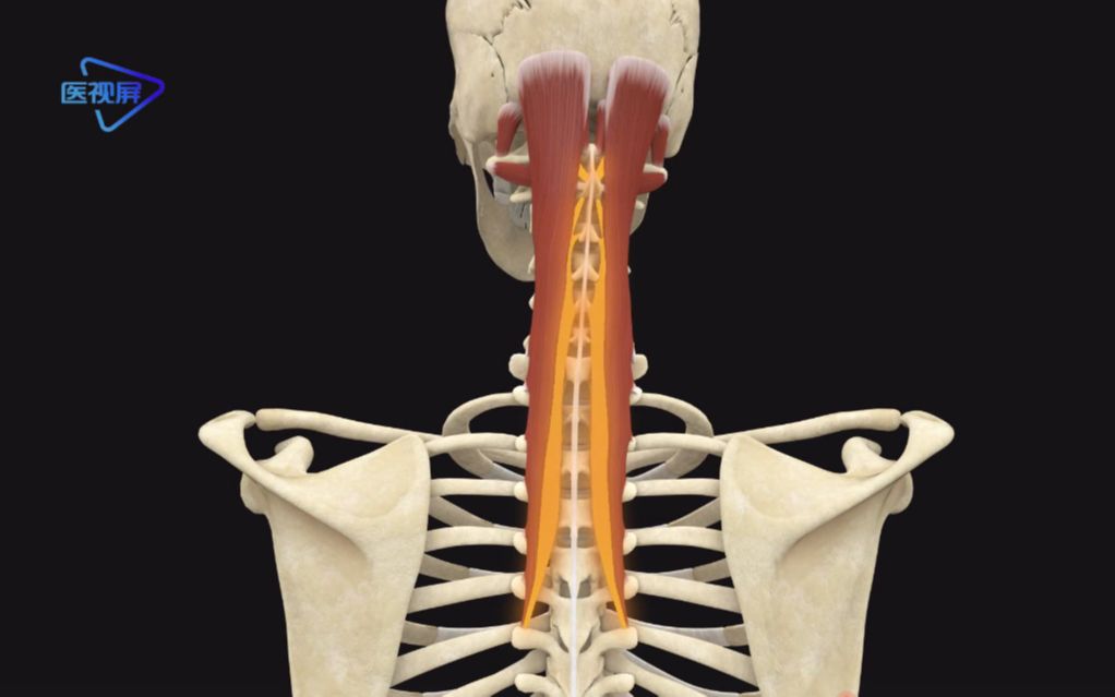 【运动解剖:头颈部疼痛之半棘肌(头半棘肌,颈半棘肌和胸半棘肌)