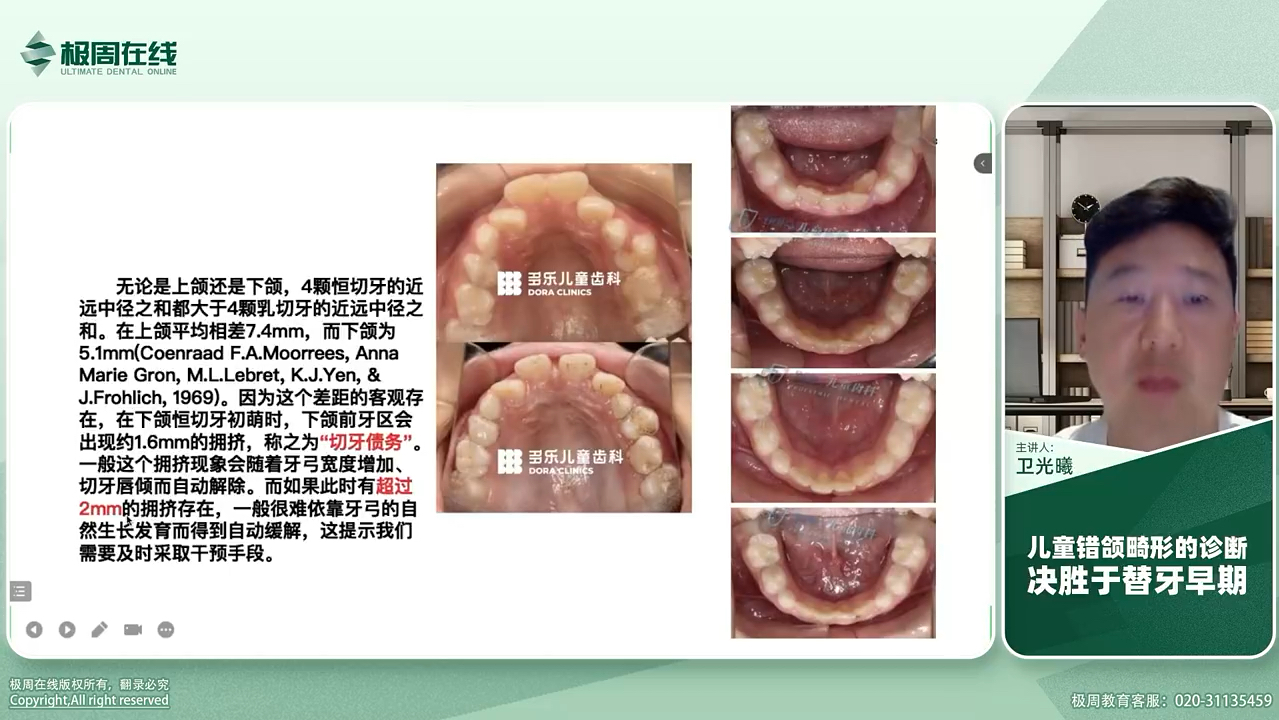做好正畸诊断分析之头影测量的检查分析——儿童错牙颌早期矫治(共32