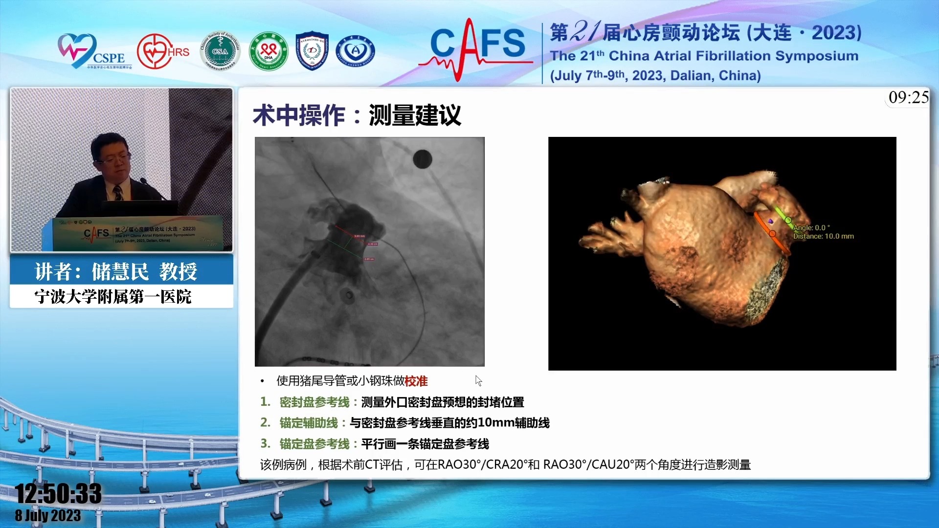 【知彼邻域】储慧民|左心耳封堵ct影像评估指导与标准化手术操作流程