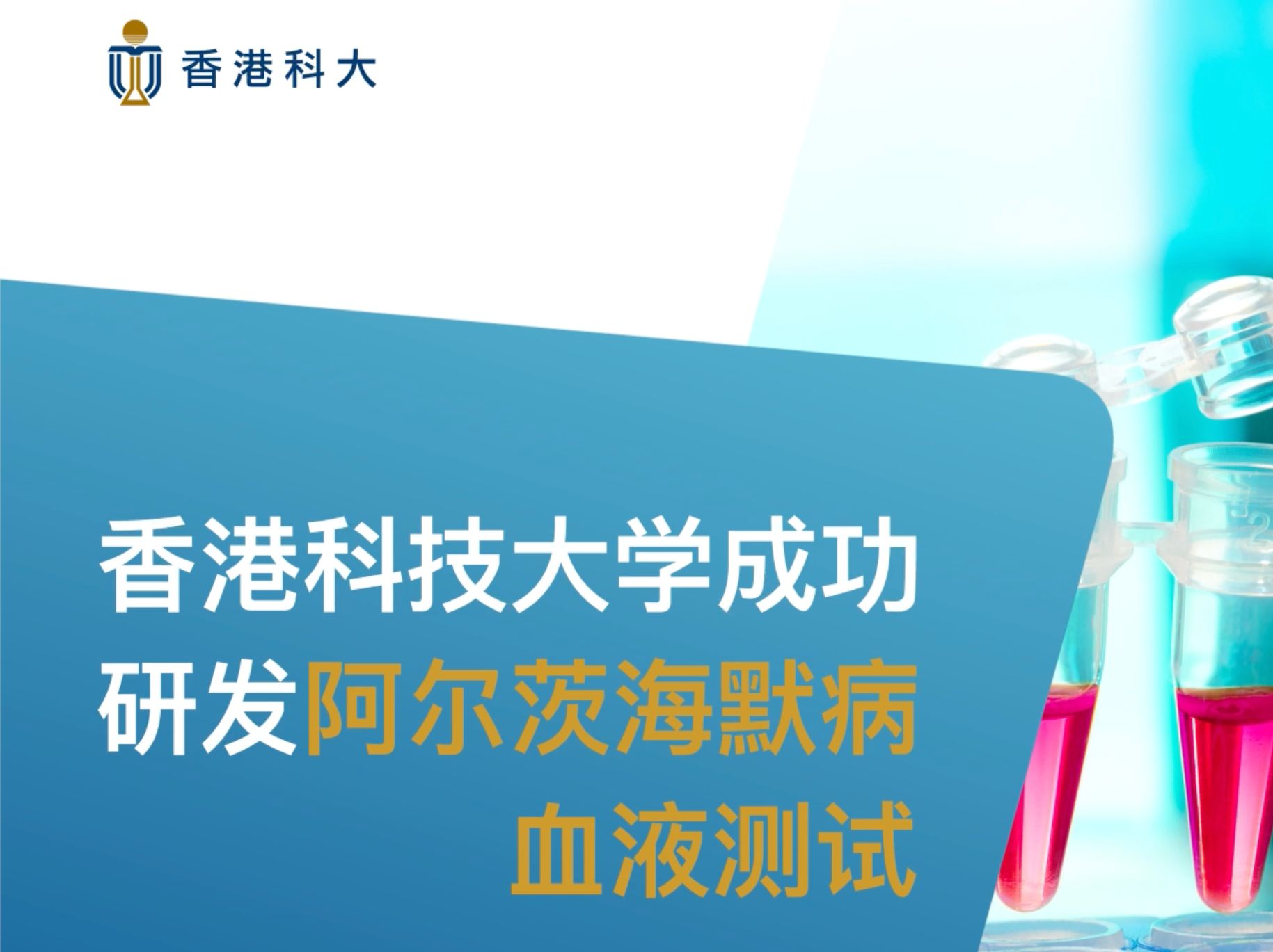 香港科技大学成功研发阿尔茨海默病血液测试哔哩哔哩bilibili