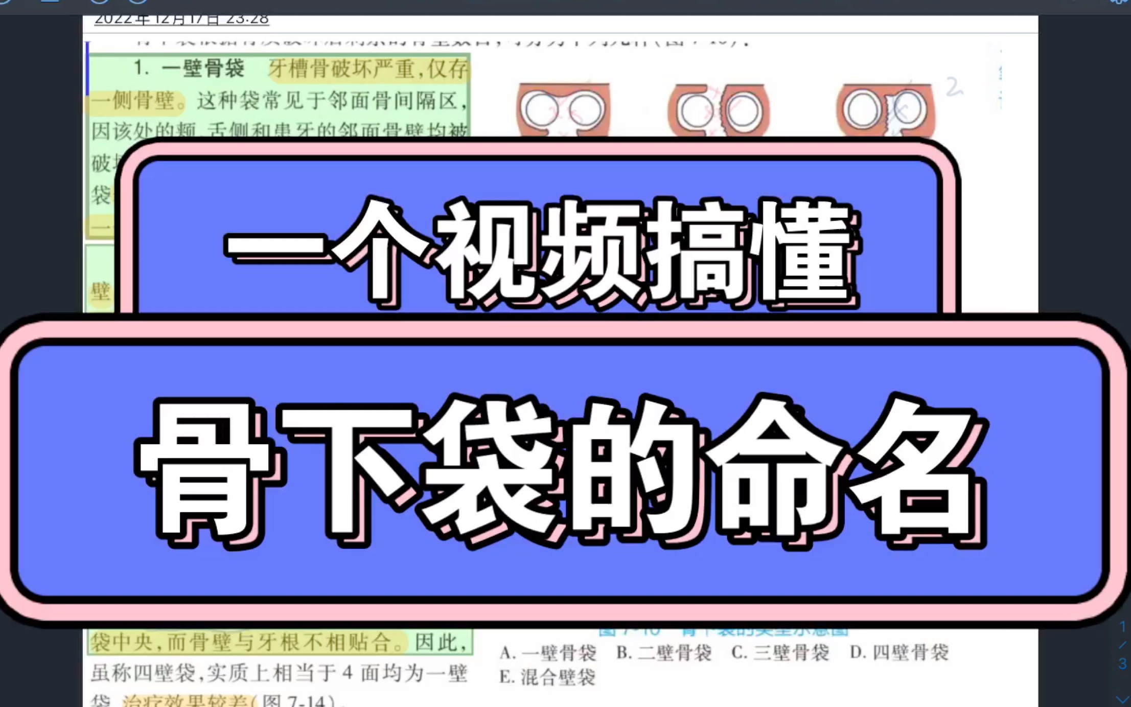 牙槽骨破坏的形式