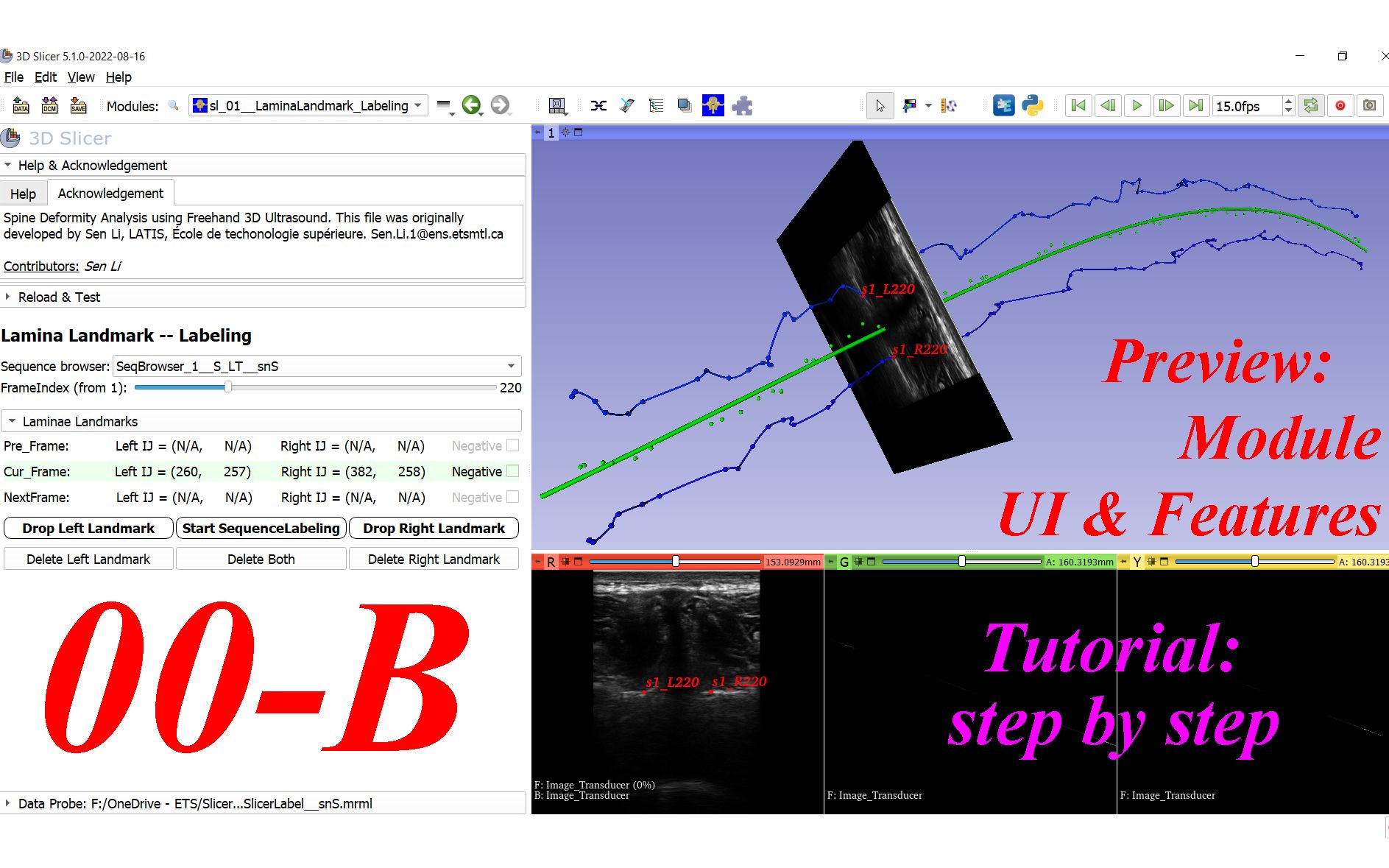 3D Slicer Lamina Landmark Labeling. #00B. Preview  module UI & features哔哩哔哩bilibili