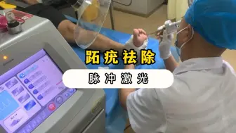 Tải video: 长了趾疣怎么办？要如何去除？