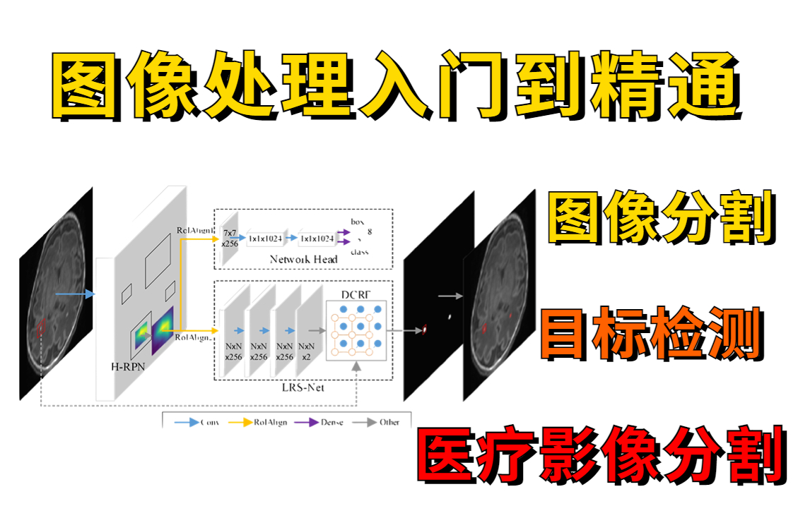 2022火爆B站的图像处理入门到精通课程!草履虫都能学会的深度学习图像分割目标检测教程(计算机视觉/医学影像分割/图像分类与检索/人工智能)哔哩哔...