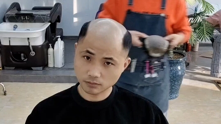 许昌市小蛐蛐假发补发男士秃顶