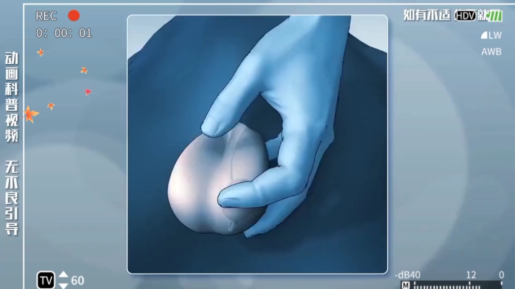 男性结扎3d全过程,看完胯下凉嗖嗖的!