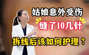 Download Video: 姑娘意外受伤缝了10几针，拆线后该如何护理呢？