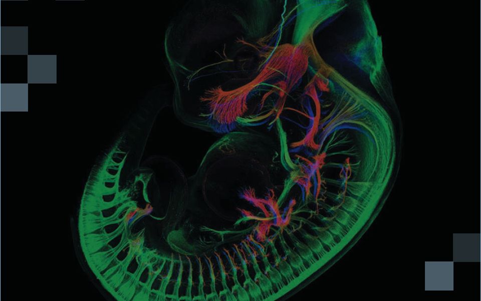 【科研进行时】生物医学文献套路精讲,科研选题立项分析哔哩哔哩bilibili