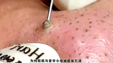 SCP239-哔哩哔哩_Bilibili