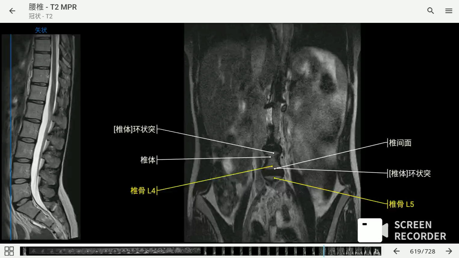 [图]影像解剖图谱神器 医学影像学必备 e-anatomy中文最新版 腰椎MRI