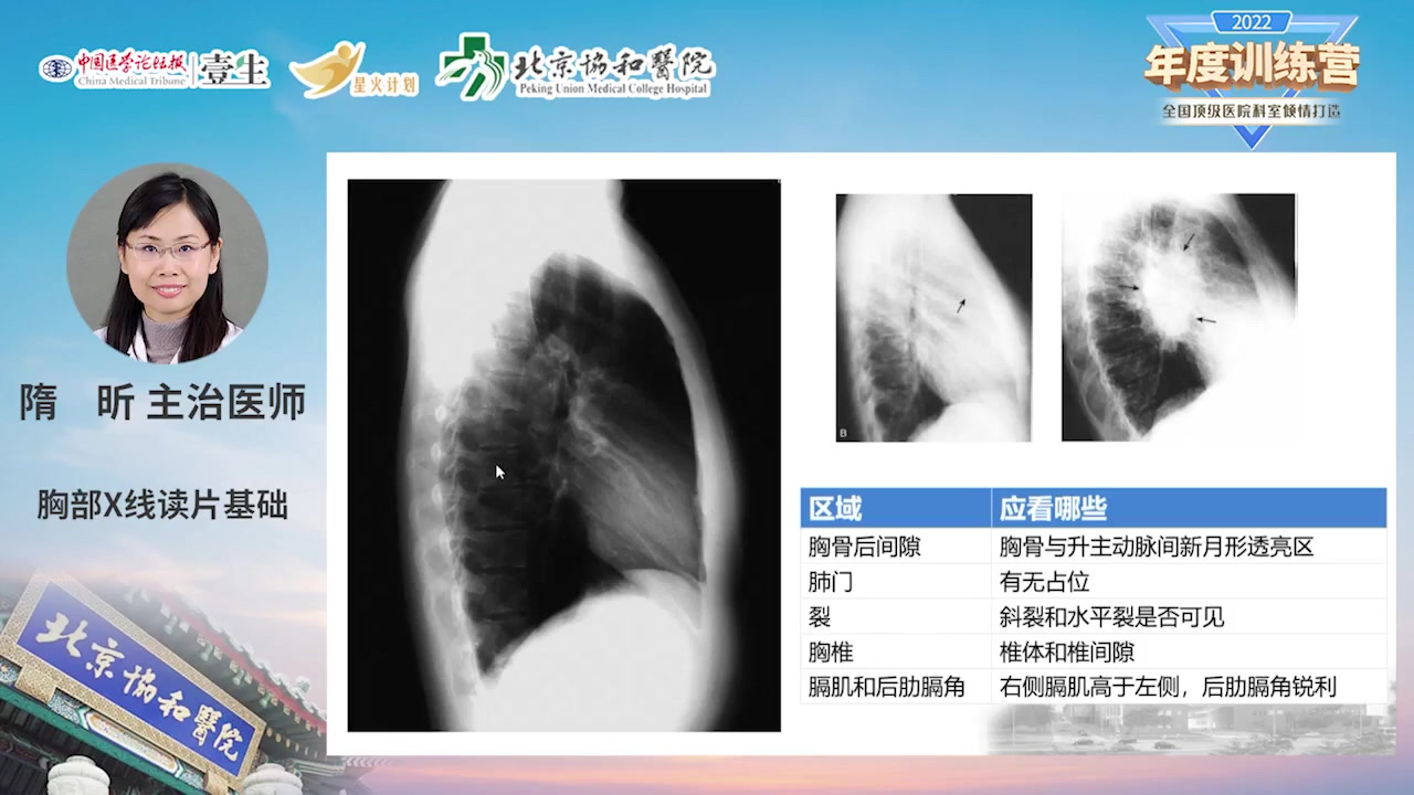 [图]协和呼吸诊疗基本功系列视频