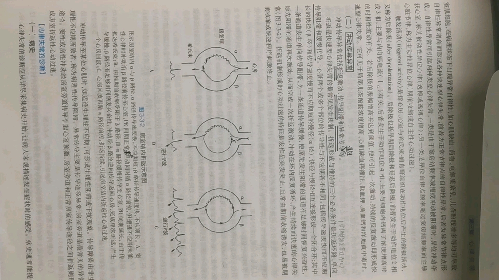 心律失常的折返机制(以房室结内折返为例)哔哩哔哩bilibili