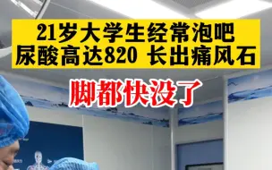 Video herunterladen: 21岁大学生经常泡吧 尿酸高达820 脚都快没了