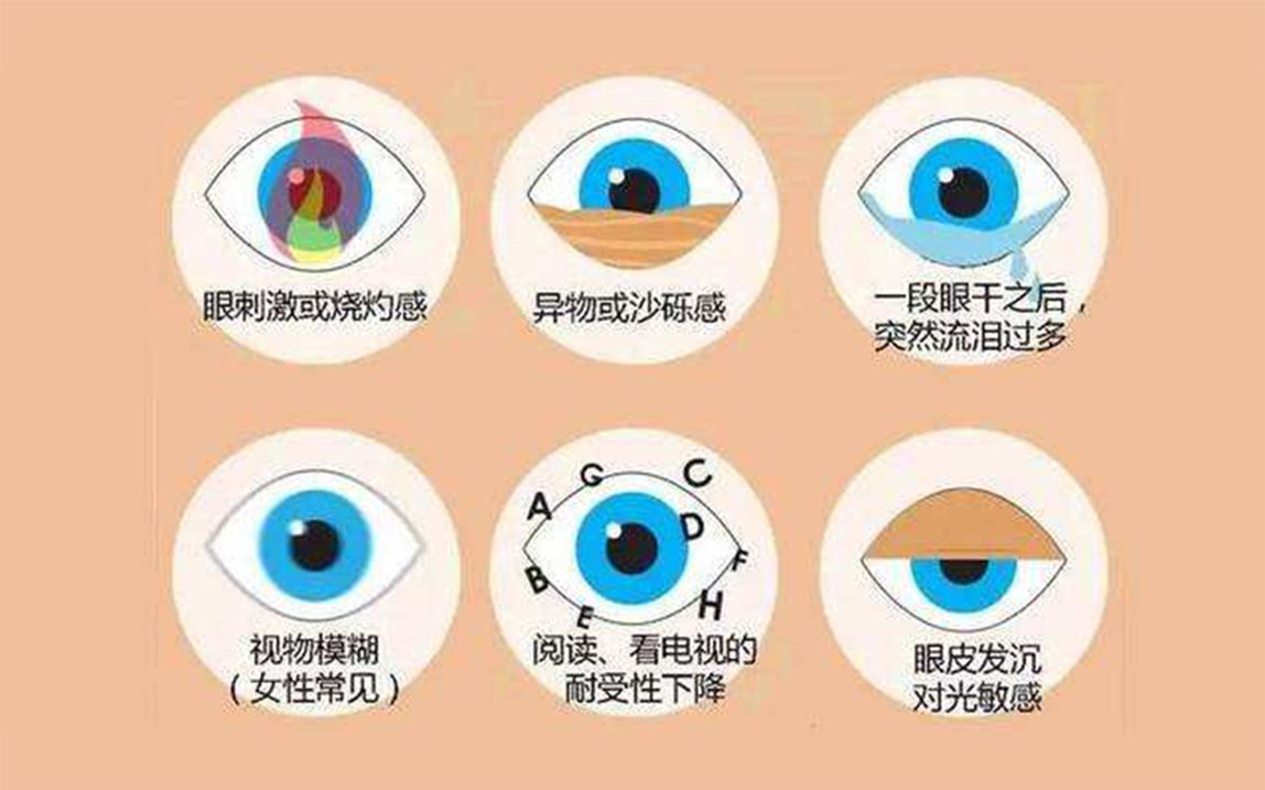 干眼小测试看看你的眼睛干不干