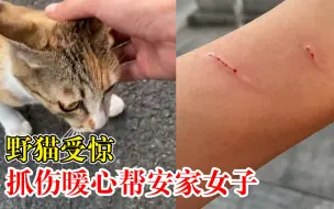 Download Video: 野猫受惊抓伤暖心帮安家女子，女子：希望大家以后不要徒手抱