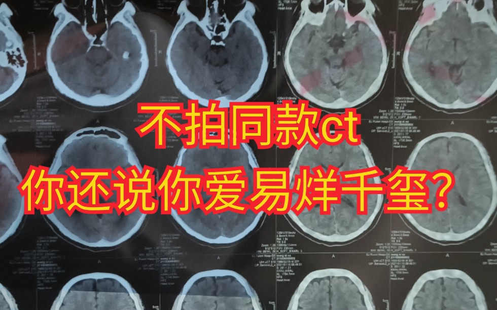 活动作品送你一朵小红花同款ct我一定是脑子有问题