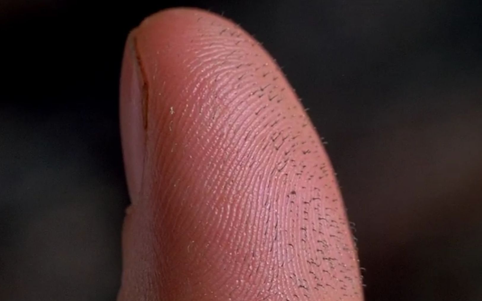 小伙被蜘蛛咬了一口,手指长出黑色刺头,原来是蜘蛛倒刺