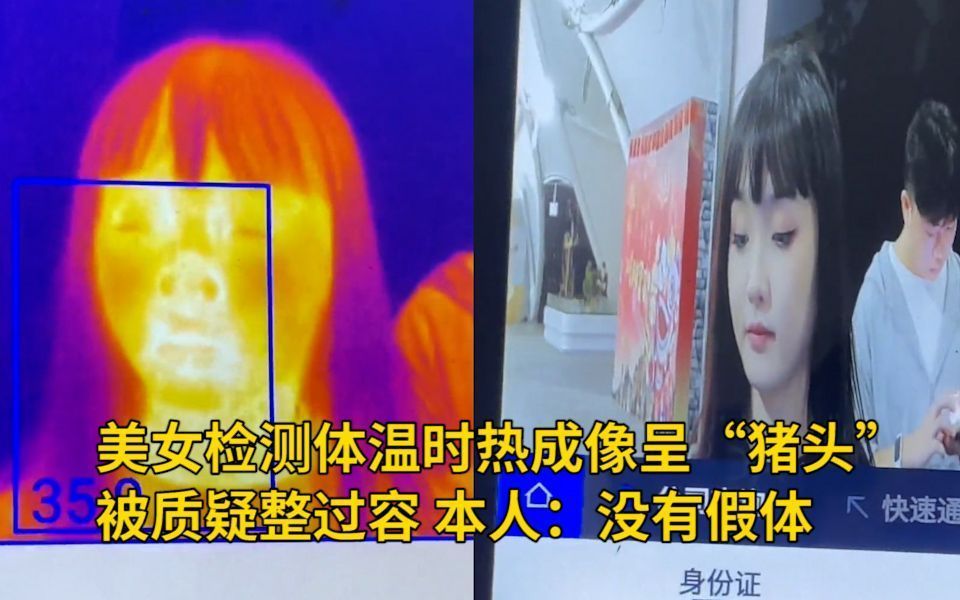 美女检测体温时热成像呈“猪头”,被质疑整过容,本人:没有假体哔哩哔哩bilibili