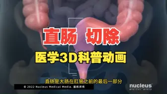 Download Video: 保护好你的直肠！直肠切除术3D动画还原 （nucleus医学科普视频系列）中文